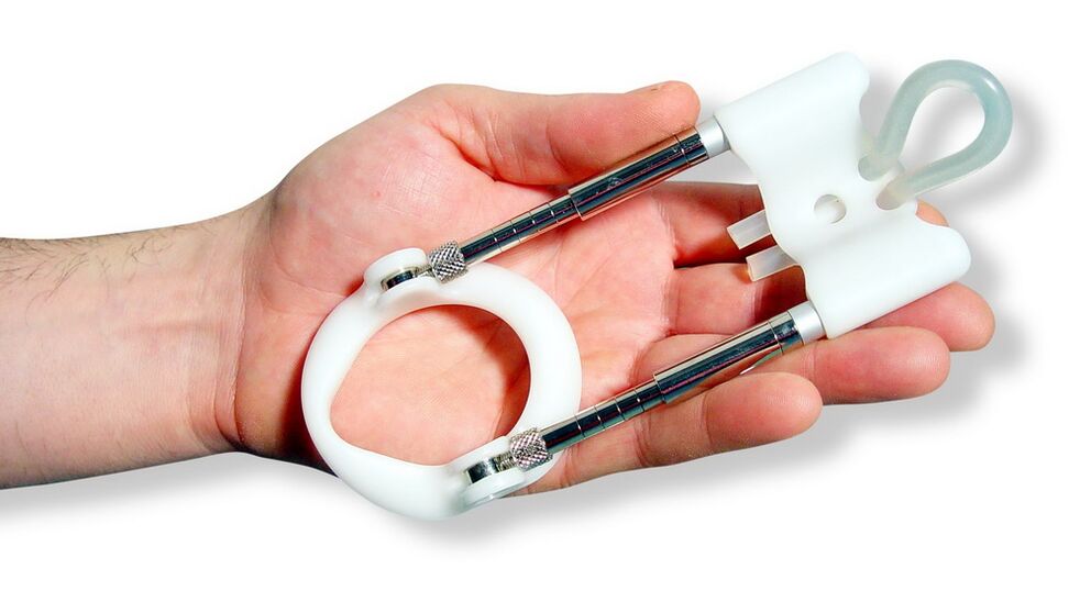 An extender is a device based on the principle of stretching the tissue in the penis